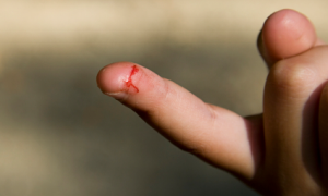 Enfant qui s’est coupé