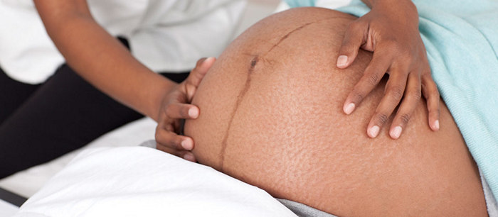 Positions in the uterus: head-down and breech presentations