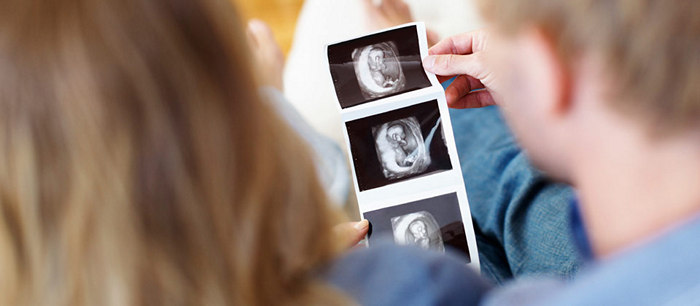 Développement de l'embryon et du foetus: 1er trimestre