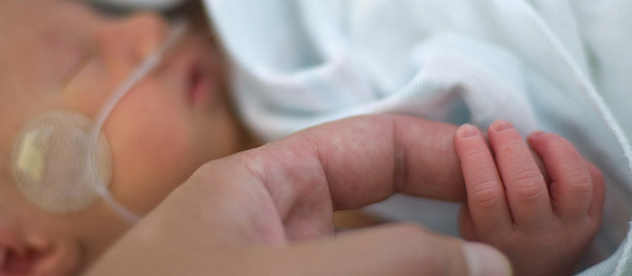 Premature babies