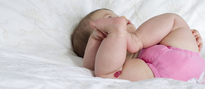 Les taches de naissance